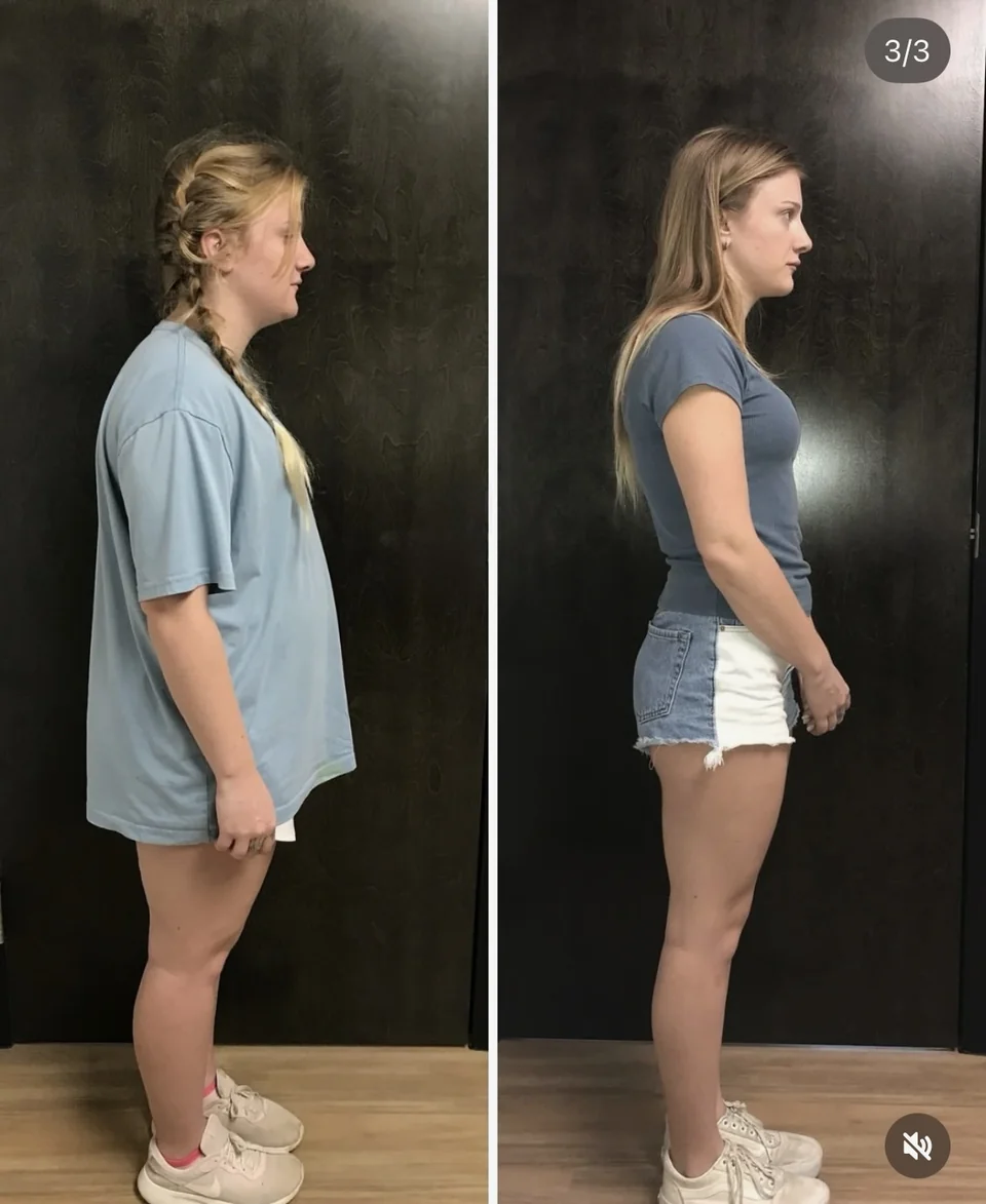 Side-by-side progress photos showing a woman standing in profile